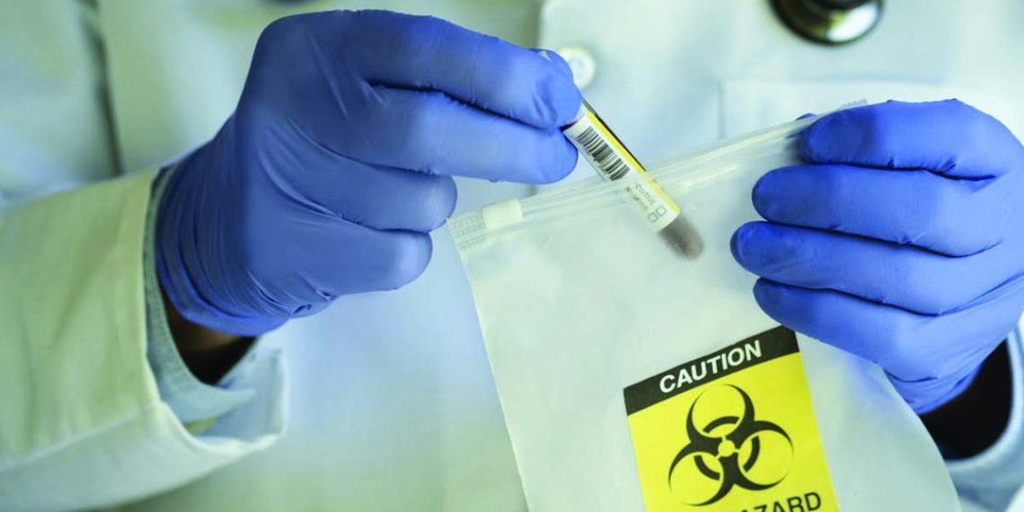 Diam-Diam AS Produksi Senjata Biologis di Ukraina