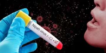 Virus Nipah-