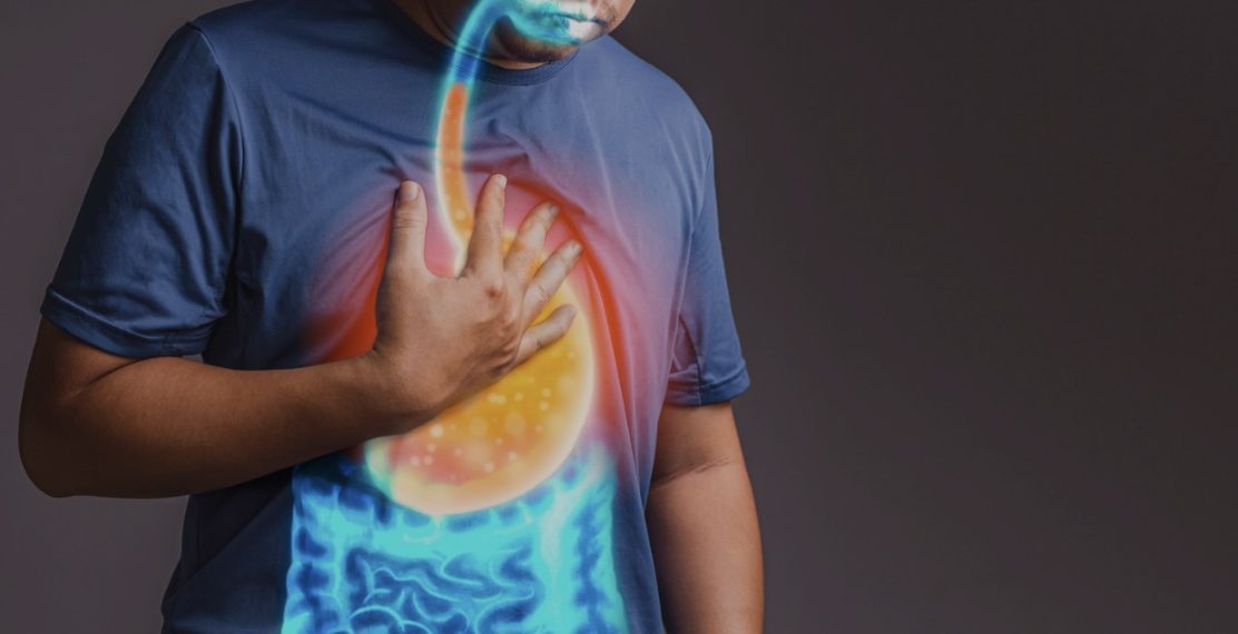 Ilustrasi penyakit gerd (foyo:istimewa)