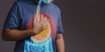 Ilustrasi penyakit gerd (foyo:istimewa)